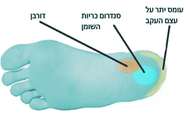 כאבים בכף הרגל