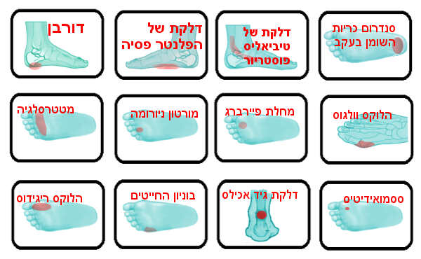 כאבים בכף הרגל